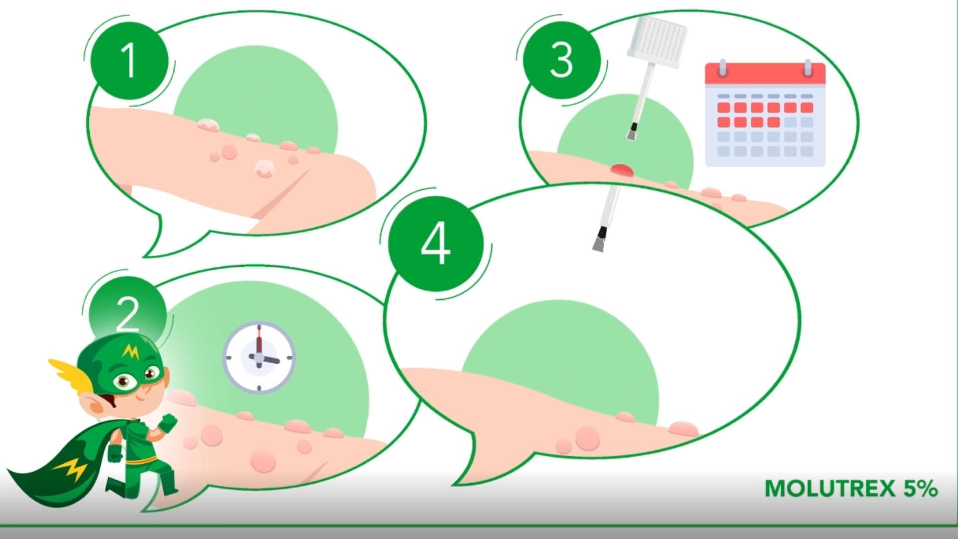 French Voice Over for Explainer Video: Molutrex and the Treatment of Molluscum Contagiosum